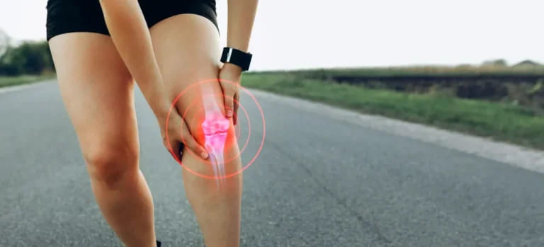 Sporty woman experiencing knee pain and tendon inflammation due to a recent knee accident, highlighting joint problems from injury